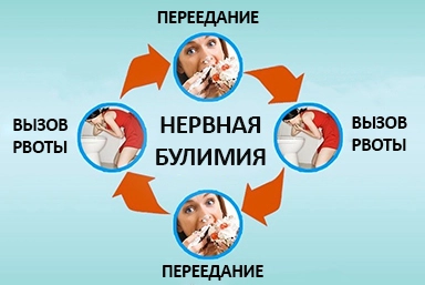 Лечение булимии в Новохоперском